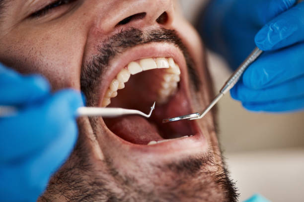 Best Emergency Denture Repair in Gowanda, NY